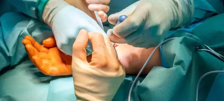 médicos em cirurgia